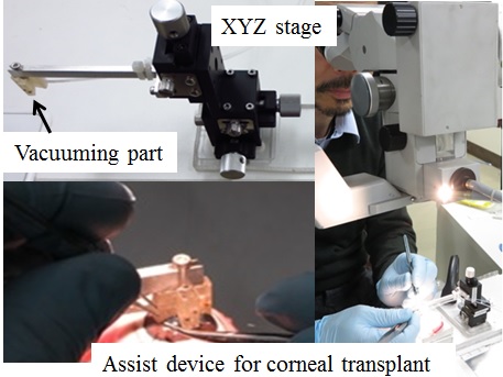 Cornea transplantation device